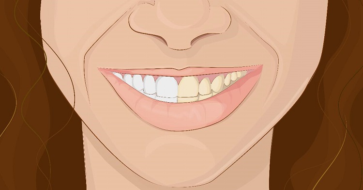 Если вы сделаете это, прежде чем почистить зубы, вы сможете сэкономить время в кресле стоматолога!